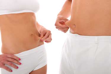 Abdominoplastik N�rnberg
