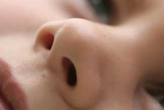 Rhinoplastik
