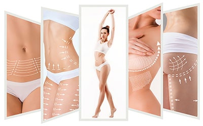 Plastische Chirurgie Arme / Bauch Beine Po / Intimbereich