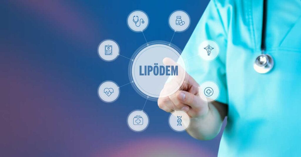 Lipödem und Steuer